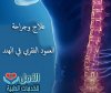 علاج وجراحة   العمود الفقري في الهند.jpg